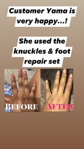 Dark Knuckles/ hand & foot repair set